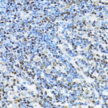 Polyclonal Rabbit anti-Human ITGB3BP Antibody (IHC)
