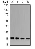 Polyclonal Rabbit anti-Human APRT Antibody (IF, WB)