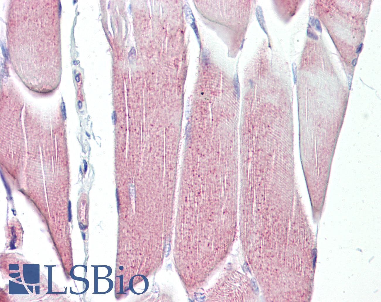 IHC-plus™ MAP2K3 / MEK3 / MKK3 Antibody (aa173-222)