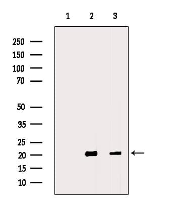 MFAP5 / MAGP2 Antibody