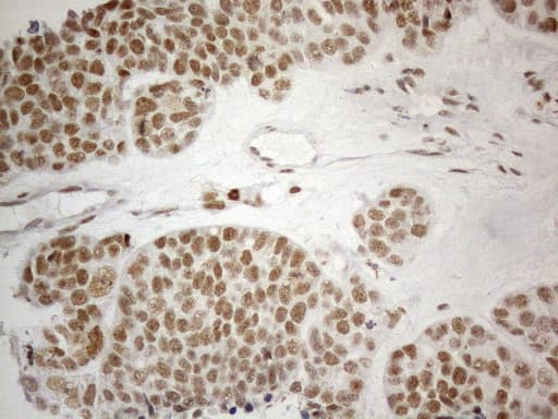Monoclonal Mouse anti-Human CWC27 Antibody (clone OTI4C8, aa145-472, IHC, WB)