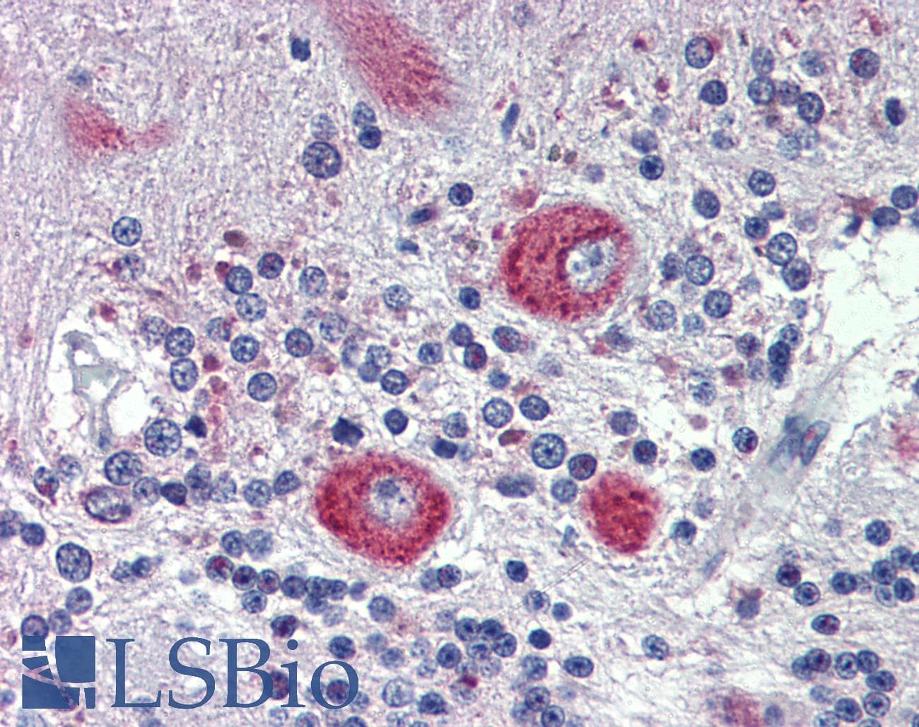 GRHL2 Antibody (C-Terminus)