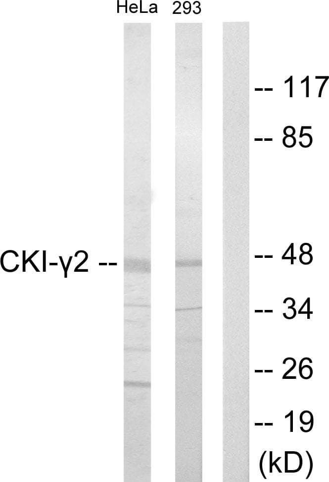 Polyclonal Rabbit anti-Human CSNK1G2 / CKI-Gamma 2 Antibody (WB)