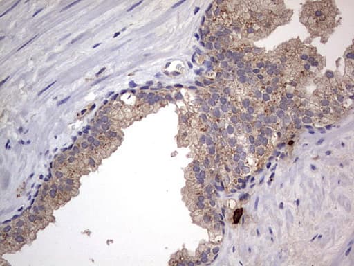 Monoclonal Mouse anti-Human SMPD1 / Acid Sphingomyelinase Antibody (clone OTI3H7, aa62-341, IHC, WB)