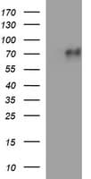 MAdCAM-1 Antibody (clone OTI1B1, Carrier-free)