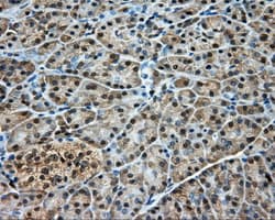 Monoclonal Mouse anti-Human DNTTIP1 / TDIF1 Antibody (clone OTI1F4, IHC, IF, WB)