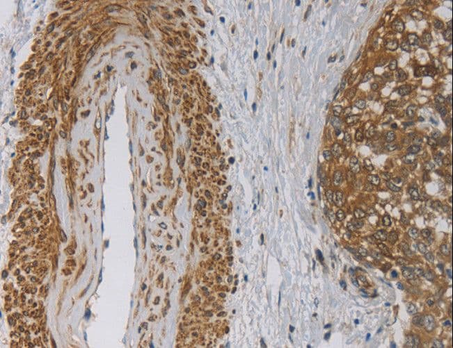 EMC8 / COX4NB Antibody