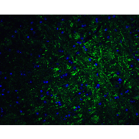 PRDM16 Antibody