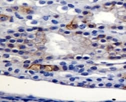 AGR2 Antibody (N-Terminus)