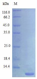Rat CXCL3 / GRO Gamma Protein (Recombinant)