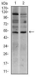 Monoclonal Mouse anti-Human TBXT / T / Brachyury Antibody (clone 1H9A2, Amino Acid: 257-309, IHC, WB)