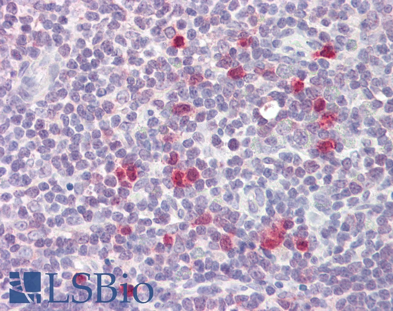 Polyclonal Rabbit anti-Human RCS / ARPP-21 Antibody (aa74-123, IHC, WB)