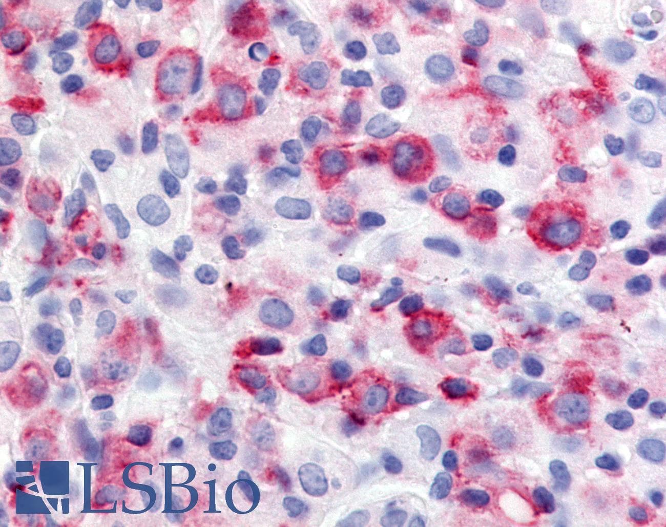 PathPlus™ USP20 / VDU2 Antibody (Internal)