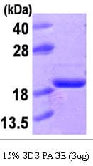 Human ACP1 / Acid Phosphatase Protein (Recombinant His)