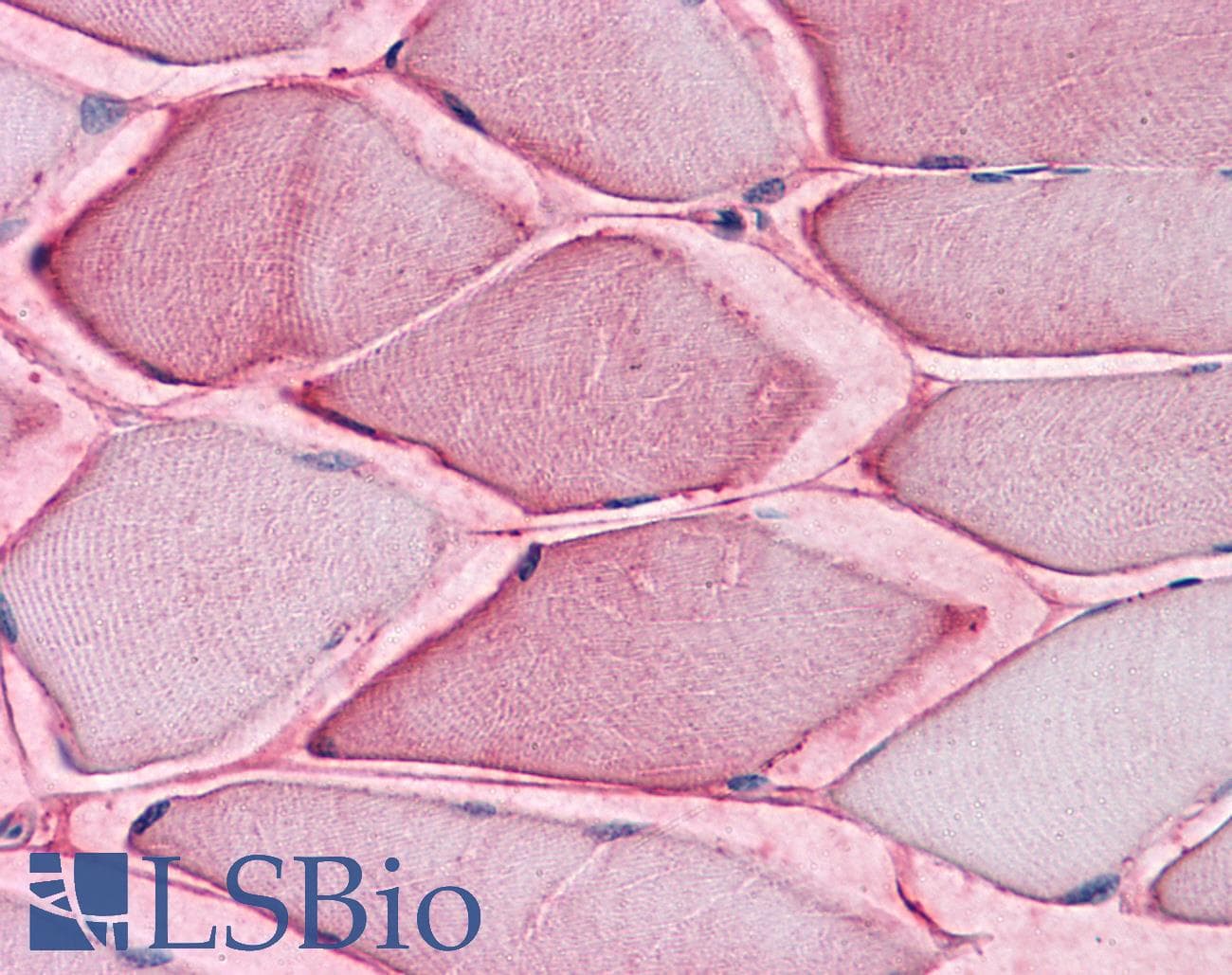 IHC-plus™ SLC1A5 / ASCT2 Antibody (Internal)