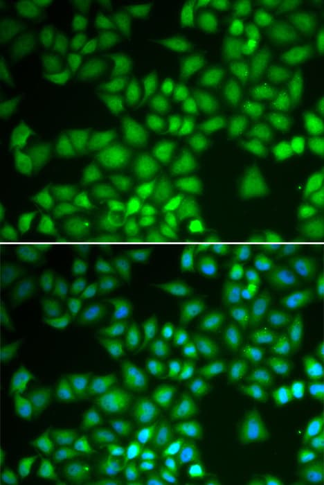 NFKB1 / NF-Kappa-B Antibody