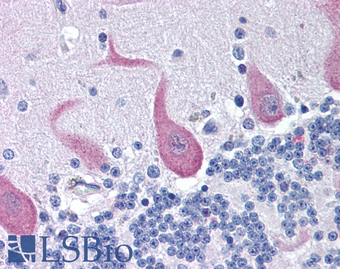 IHC-plus™ FAIM2 / LIFEGUARD Antibody (aa1-50)