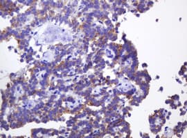 ABCB1 / MDR1 / P Glycoprotein Antibody (aa995-1280, clone OTI2G6, Carrier-free)