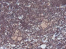 Monoclonal Mouse anti-Human MGLL / Monoacylglycerol Lipase Antibody (clone OTI1B1, IHC, IF, WB)