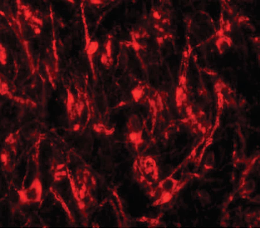 Polyclonal Rabbit anti-Human LCMT2 / YW4 Antibody (IHC, IF, WB)