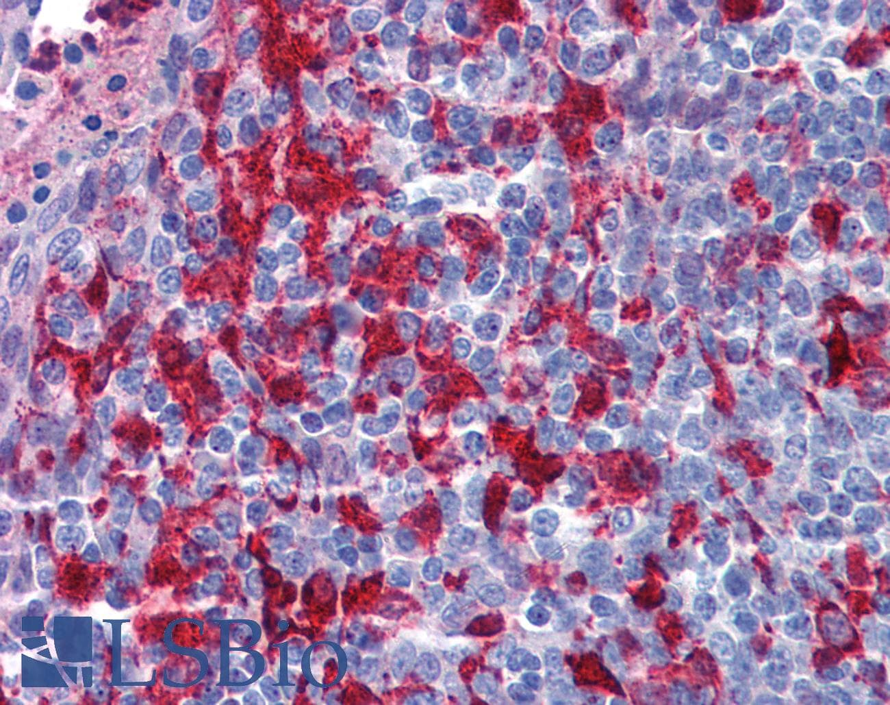 Polyclonal Rabbit anti-Human GSN / Gelsolin Antibody (aa542-591, IHC, WB)