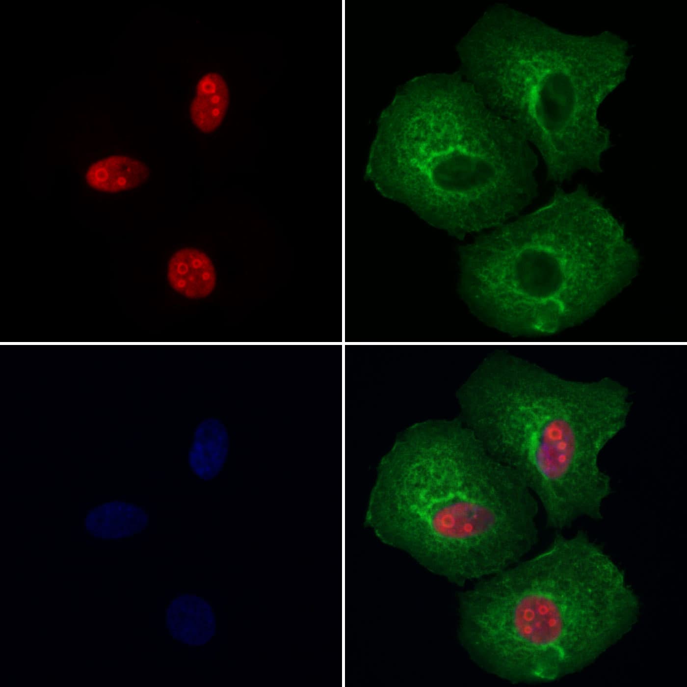 NCL / Nucleolin Antibody