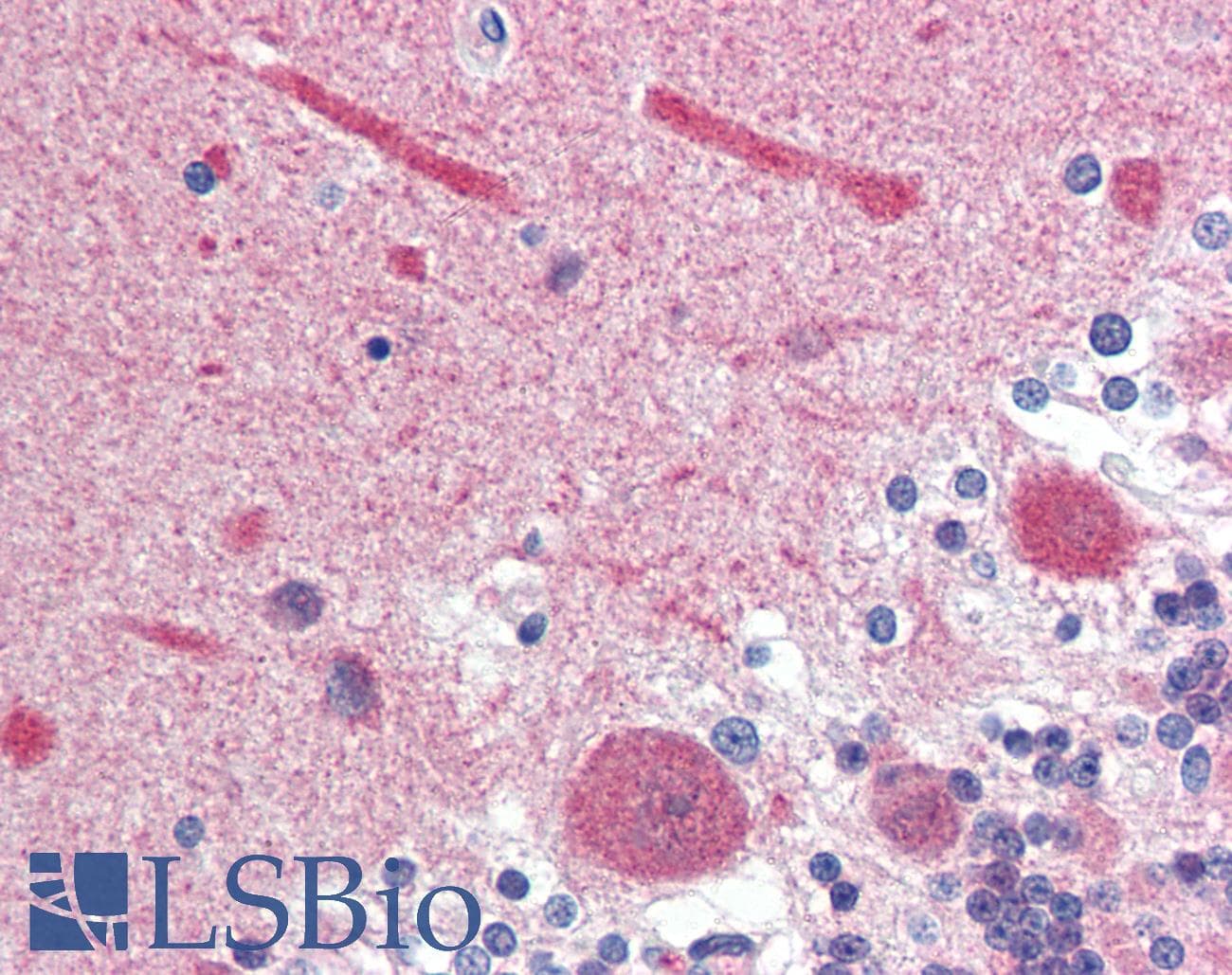 IHC-plus™ Calmodulin Antibody (aa1-149, clone J4D8)