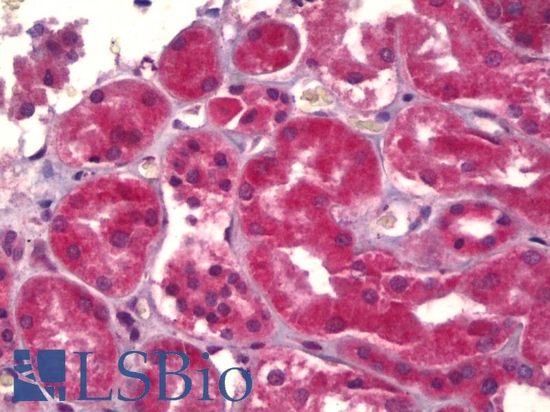 IHC-plus™ ABCB5 Antibody