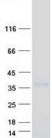 Human LRRC3B Protein (Recombinant Myc-DDK (Flag))