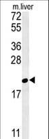 GM2A Antibody (aa25-54)