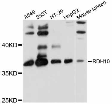 Polyclonal Rabbit anti-Human RDH10 Antibody (WB)