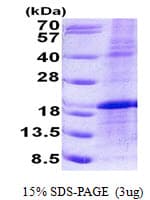 Human LMO1 Protein (Recombinant His)