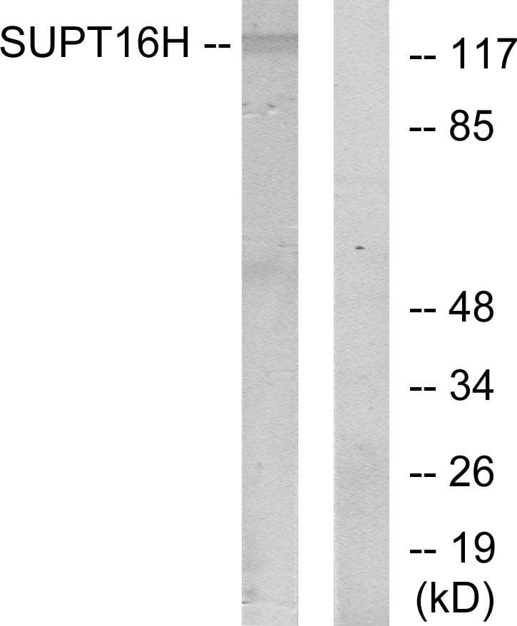 Polyclonal Rabbit anti-Human SUPT16H / FACTP140 Antibody (WB)