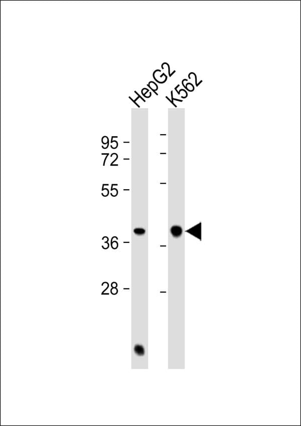 REN / Renin 1 Antibody