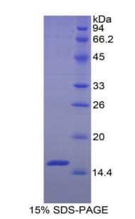 Mouse AOC1 Protein (Recombinant His)