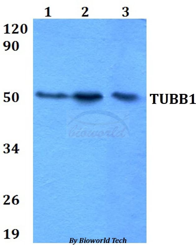 TUBB1 / Tubulin Beta 1 Antibody