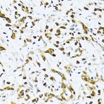 Polyclonal Rabbit anti-Human ITGB3BP Antibody (IHC)