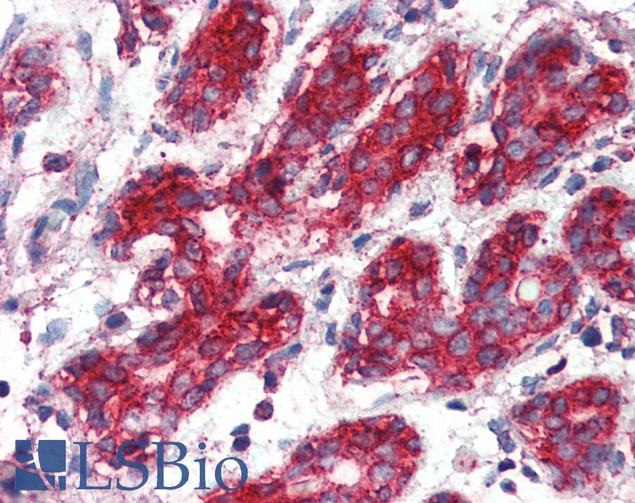 PathPlus™ SOD2 / Mn SOD Antibody