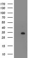 Monoclonal Mouse anti-Human ZFP36 / Tristetraprolin Antibody (clone OTI3H1, WB)