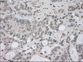 NEK6 Antibody (clone OTI5D7)