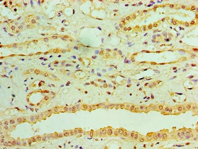 RDH11 Antibody
