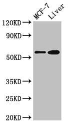 Polyclonal Rabbit anti-Human CBS Antibody (IHC, IF, WB)