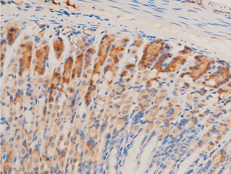 TGFB1 / TGF Beta 1 Antibody