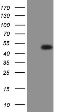 RORB / ROR Beta Antibody (aa1-260, clone OTI3D7)