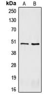 IHC-plus™ Polyclonal Rabbit anti-Human CRHR2 / CRF2 Receptor Antibody (Internal, IHC, WB)