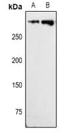 Polyclonal Rabbit anti-Human MKI67 / Ki67 Antibody (IHC, IF, WB)