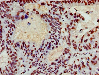 Polyclonal Rabbit anti-Human HIST1H3A Antibody (IHC, IF, WB)