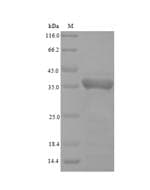 Charybdis feriata VP3 / Apoptin Protein (Recombinant 6His, N-terminus)