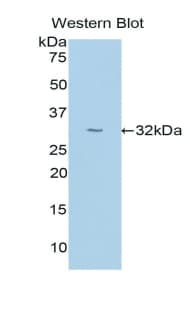 UMOD / Uromodulin Antibody (aa334-589)