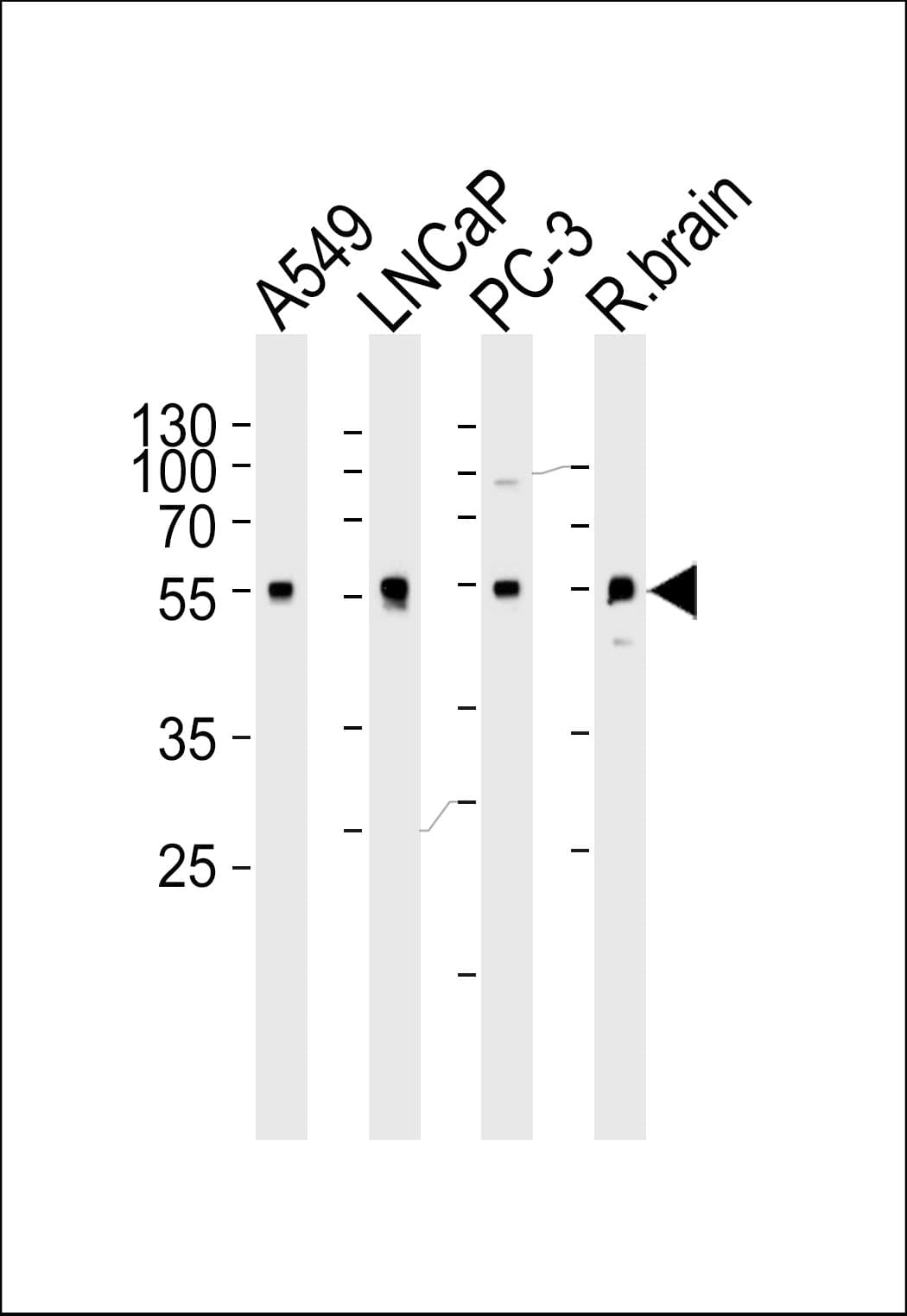 Polyclonal Rabbit anti-Human ADRA1D / Adrenoceptor alpha 1D Antibody (aa1-30, IHC, WB)